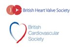 A Statement from the British Heart Valve Society (BHVS), the Society for Cardiothoracic Surgery (SCTS) and the British Cardiovascular Society (BCS)